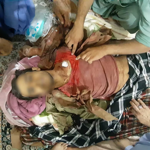 محمداقبال نایب‌زهی، کودک کار بلوچ که توسط رژیم کودک کش در زاهدان کشته شد